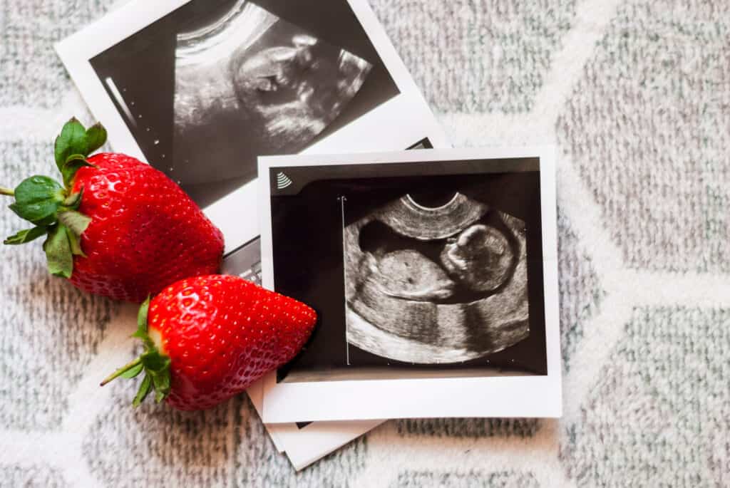 An ultrasound photo of a baby and two strawberries to encourage healthy nutrition during pregnancy